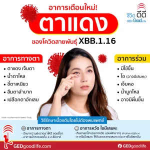 อาการตาแดง สัญญาณเตือนรอบใหม่ของไวรัสโควิดสายพันธุ์ XBB.1.16