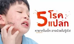 5 โรคแปลกหายากในเด็ก ที่อาจทำลูกป่วยโดยไม่รู้ตัว