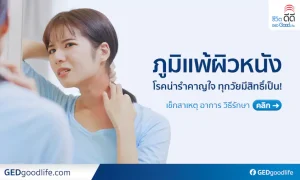 โรคภูมิแพ้ผิวหนัง มีสาเหตุ อาการ วิธีรักษาอย่างไร?