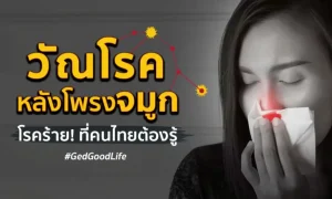 “วัณโรคหลังโพรงจมูก” โรคร้าย! ที่คนไทยต้องรู้