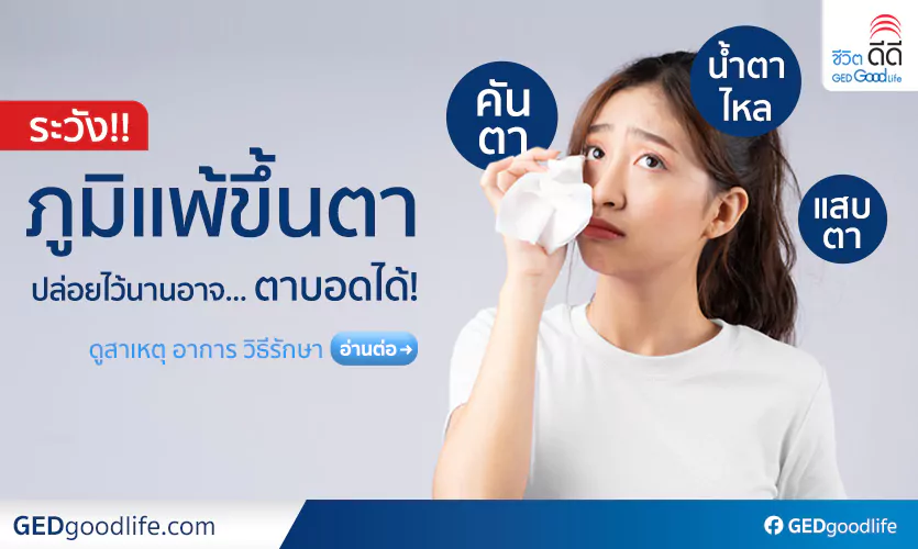 ภูมิแพ้ขึ้นตา คันตา แสบตา น้ำตาไหล เป็นแล้วต้องรีบรักษาให้ถูกจุด!