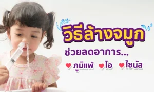 เทคนิค “การล้างจมูก” ลดภูมิแพ้ ไซนัสอักเสบ ไอเรื้อรัง