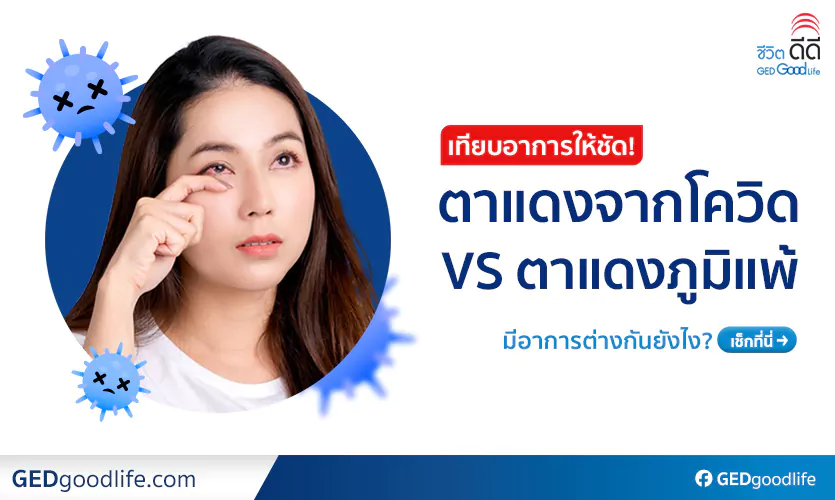 เช็กให้ชัวร์! ตาแดงจากโควิด VS ภูมิแพ้ขึ้นตา ต่างกันยังไง รักษายังไงดี?