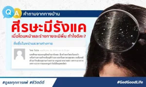 ศีรษะมีรังแค เมื่อโดนหน้าและร่างกายจะขึ้นผื่น ทำไงดี?