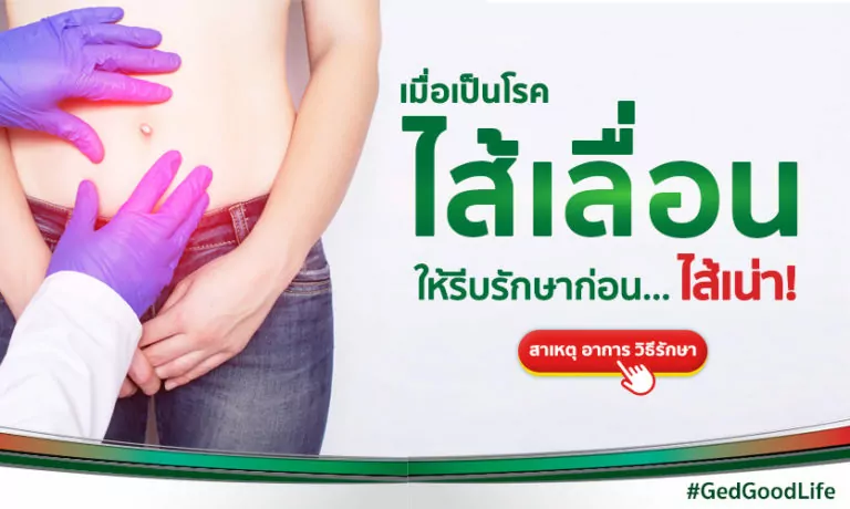 เมื่อเป็น “ไส้เลื่อน” ให้รีบรักษา ก่อนไส้เน่า!