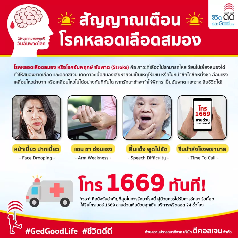 สัญญาณเตือน โรคหลอดเลือดสมอง รู้ทัน เซฟชีวิตได้!