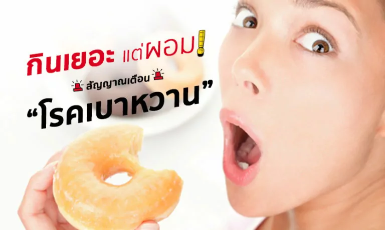 กินเยอะ แต่ผอม! สัญญาณเตือน “โรค เบาหวาน”