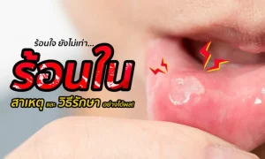 “ร้อนใน” สาเหตุ และวิธีรักษาอย่างได้ผล