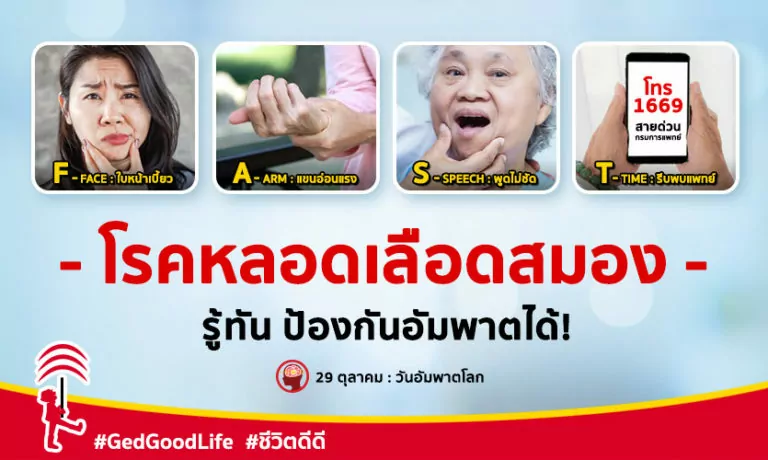 โรคหลอดเลือดสมอง รู้ทัน ป้องกันอัมพาตได้! : สาเหตุ อาการ วิธีรักษา