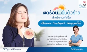 GEDไว้ไม่คัน ผดร้อน ผื่นตัวร้ายคนเจ้าเนื้อดูแลอย่างไร| GED