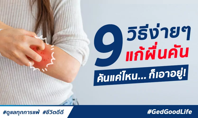 ผื่นคัน ผิวหนังอักเสบ แก้ได้ด้วย 9 วิธีนี้ คันแค่ไหนก็เอาอยู่!