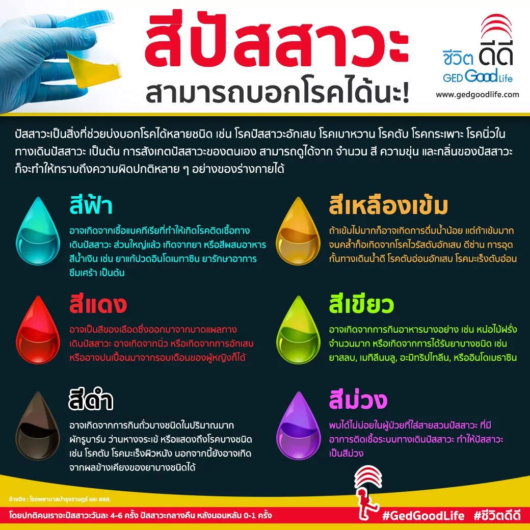 เคยสังเกตกันไหม? สีของปัสสาวะ สามารถบอกโรคเราได้ด้วยนะ! I Ged Good Life