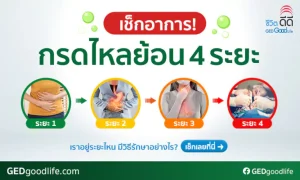 เช็กอาการ! กรดไหลย้อน 4 ระยะ มีอาการ และวิธีรักษาอย่างไร?