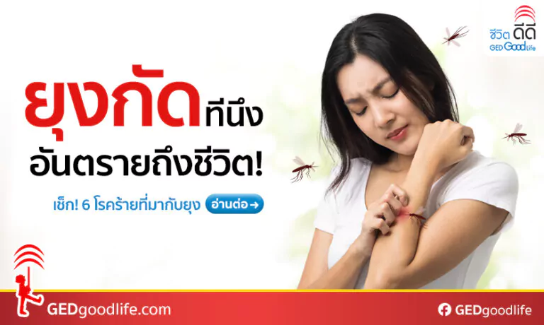 หน้าฝนยุงชุม ต้องระวัง! 5 โรคที่เกิดจากยุงกัด ทำป่วยมีไข้สูงเฉียบพลัน